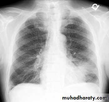 Pharmacology for Respiratory