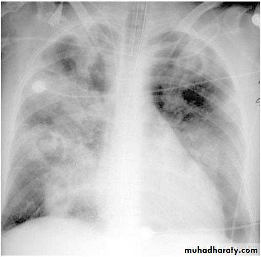 Pharmacology for Respiratory