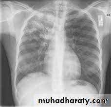 Pharmacology for Respiratory