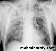 Pharmacology for Respiratory