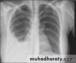 Pharmacology for Respiratory