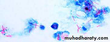 Pharmacology for Respiratory