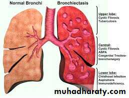 Pharmacology for Respiratory