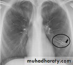 Pharmacology for Respiratory