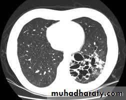 Pharmacology for Respiratory