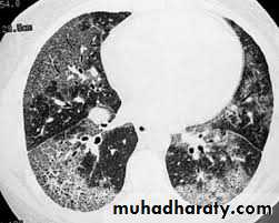 Pharmacology for Respiratory