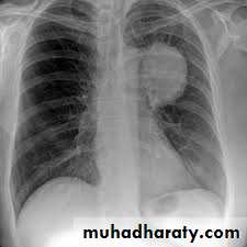 Pharmacology for Respiratory