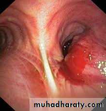 Pharmacology for Respiratory