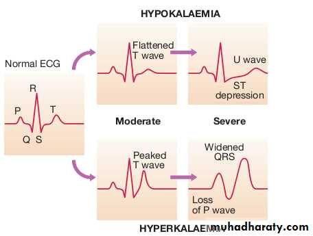 disorders of k balance