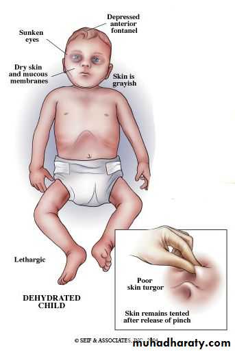 ACUTE GASTROENTERITIS