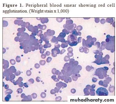 Pneumonia