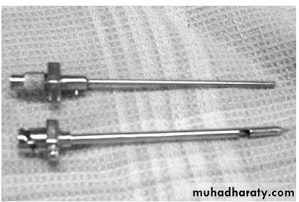 Pleural effusion