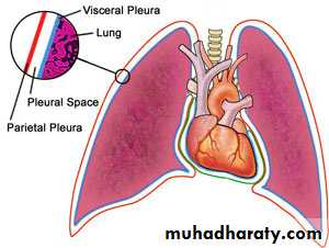 Pleural effusion