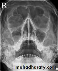 Nasal cavity