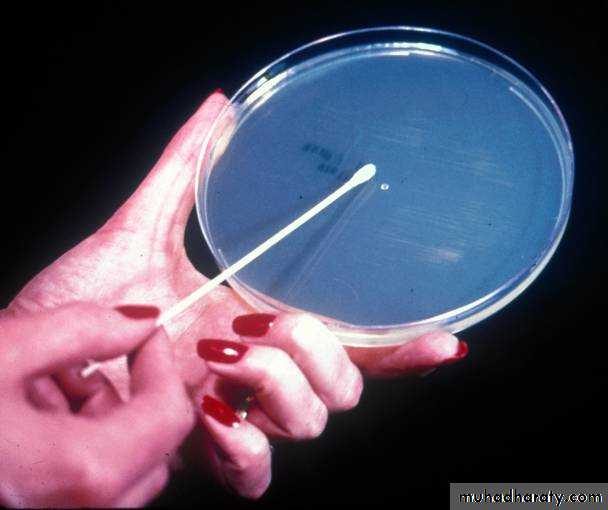 Antibiotic sensitivity testing
