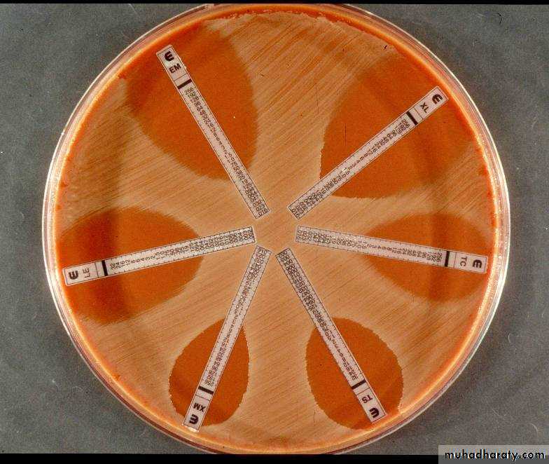 Antibiotic sensitivity testing