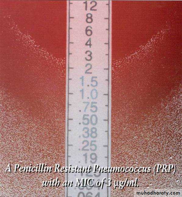 Antibiotic sensitivity testing