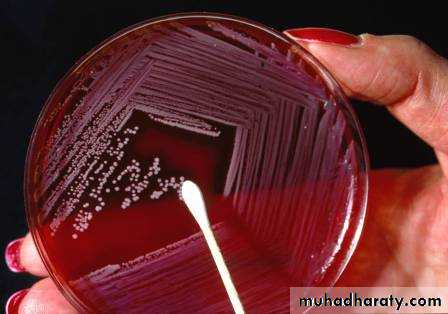 Antibiotic sensitivity testing