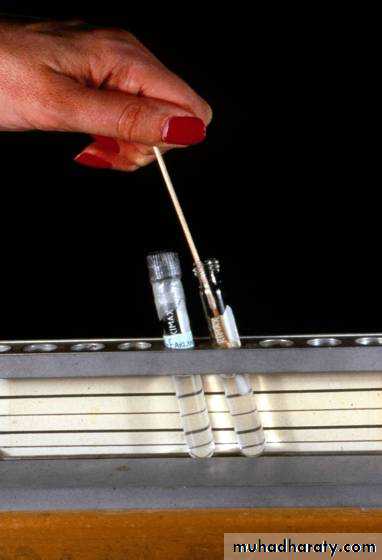 Antibiotic sensitivity testing