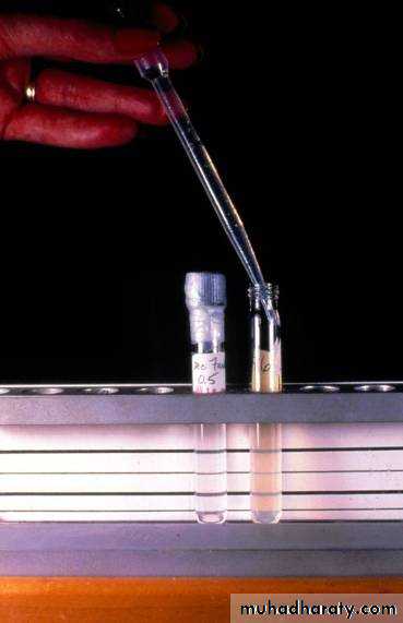 Antibiotic sensitivity testing