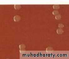 Practical non enteric G n rods