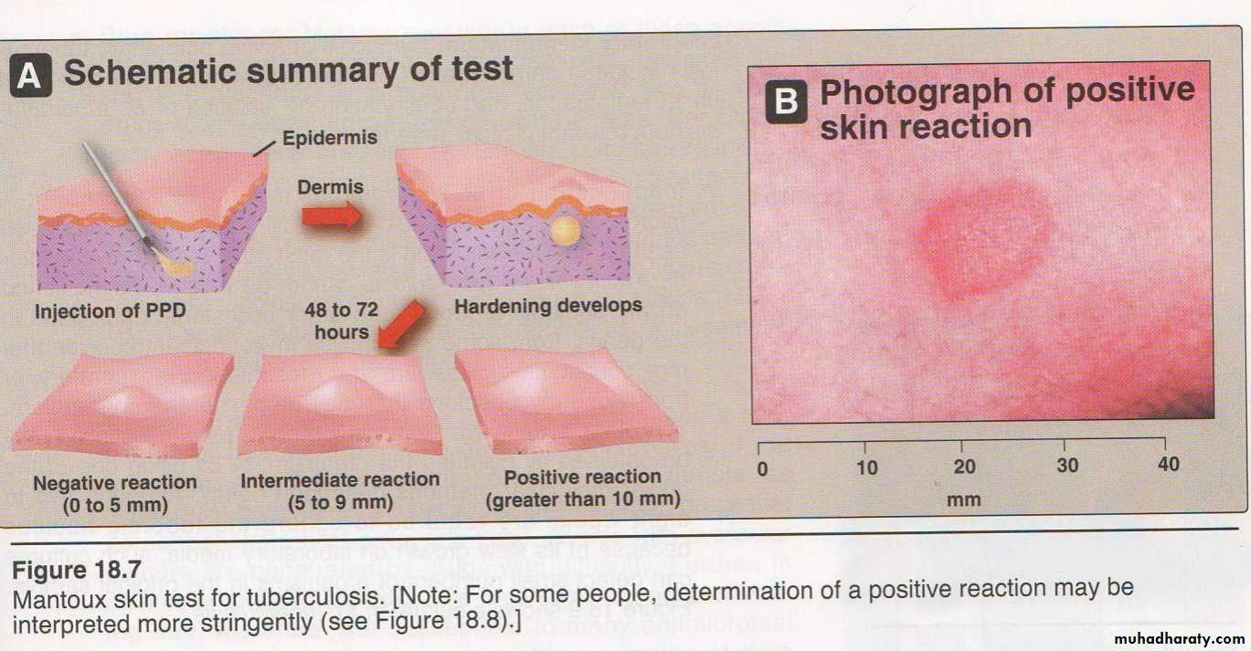 Practical non enteric G n rods