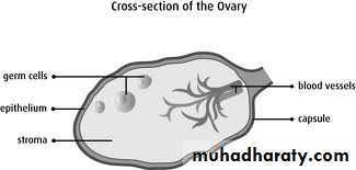 benign overian tumor