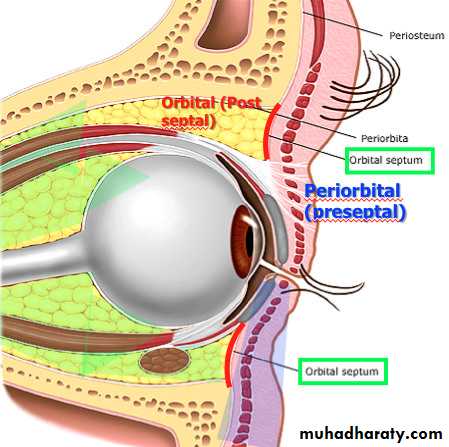 orbital and periorbital infectioun