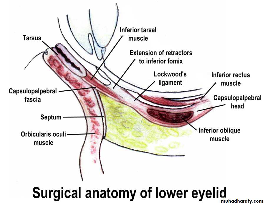 orbital and periorbital infectioun