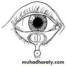 orbital and periorbital infectioun