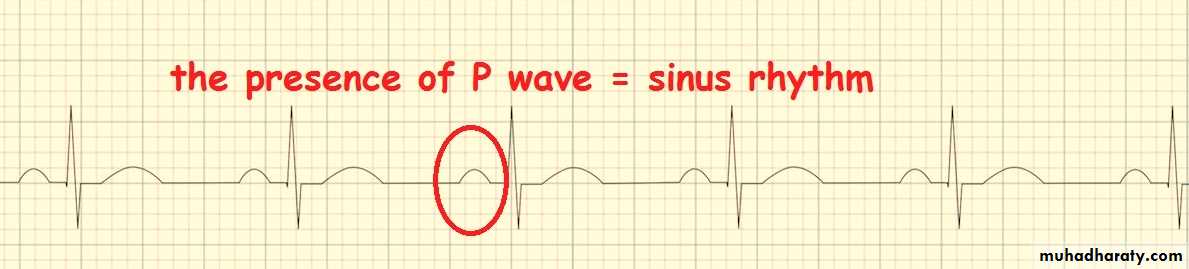 ECG Notes
