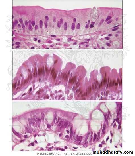 General histo theory