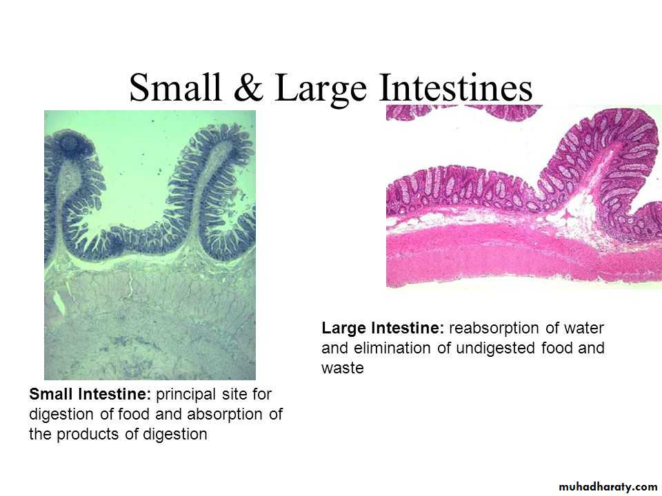 General histo theory