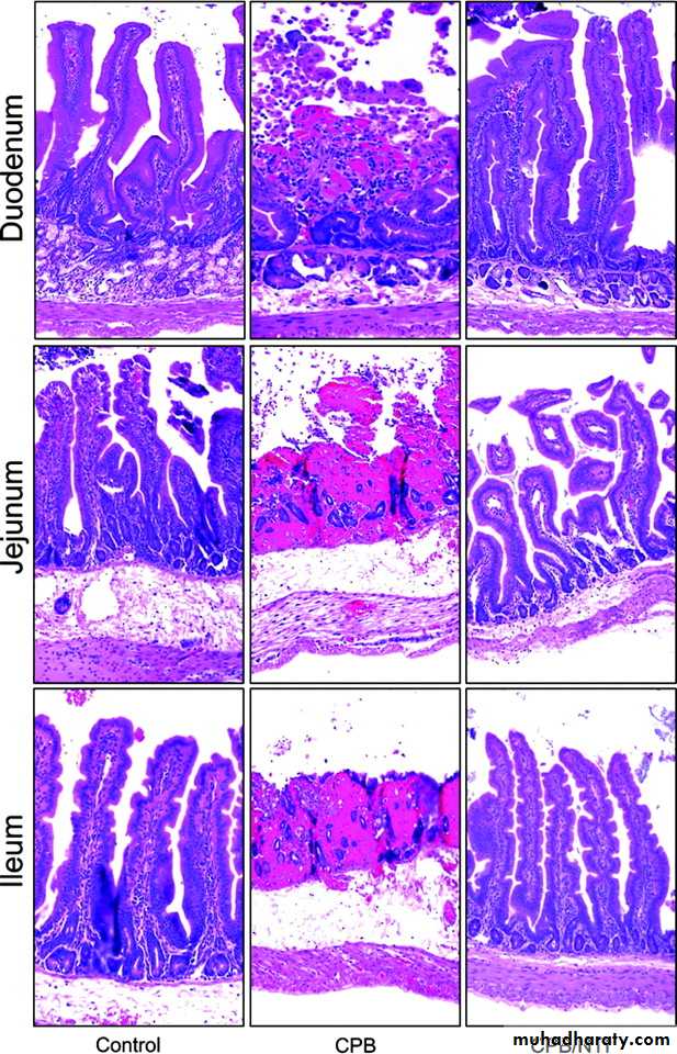 General histo theory