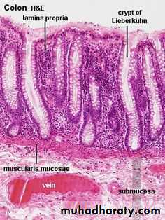General histo theory