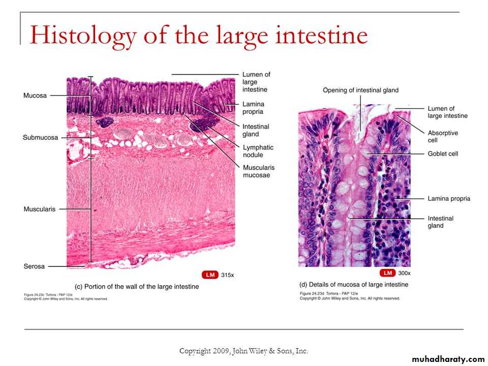 General histo theory