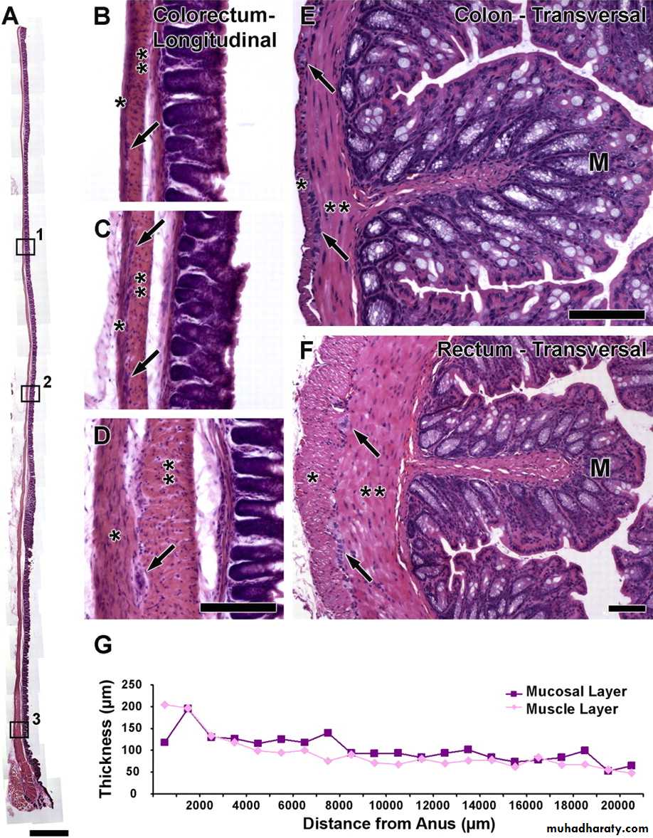 General histo theory