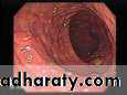 General histo theory