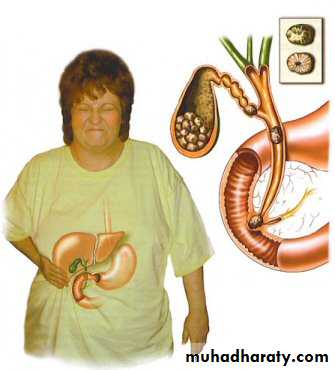 General histo theory