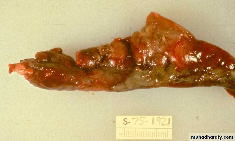 General histo theory