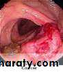 General histo theory