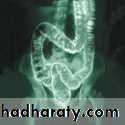 General histo theory