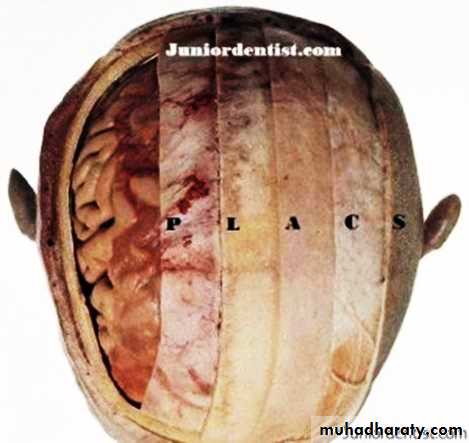 the head