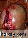 the head