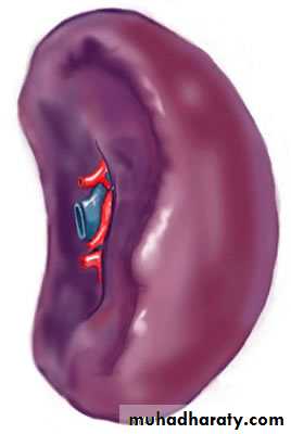 lymphoid system