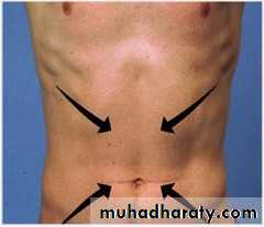 spinal cord 3