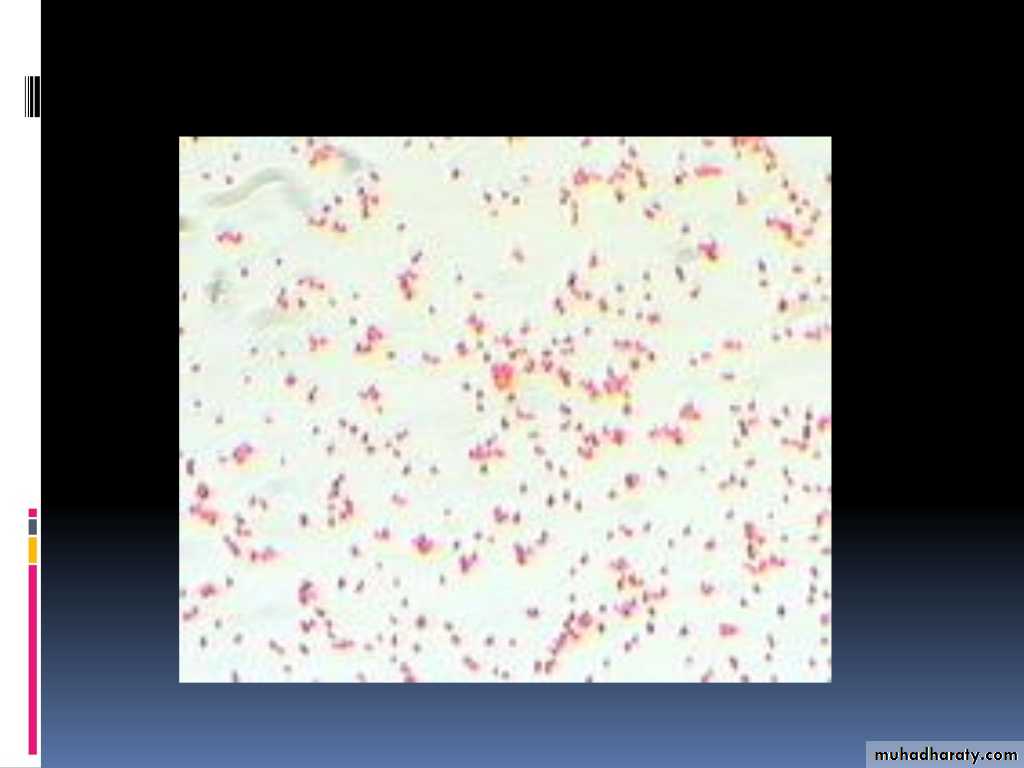 Streptococcus Pneumonia