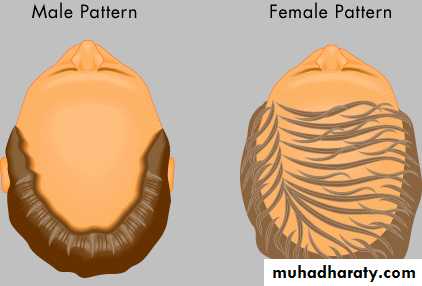 Alopecia