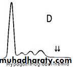 Lab 2 (Ag-Ab reaction)