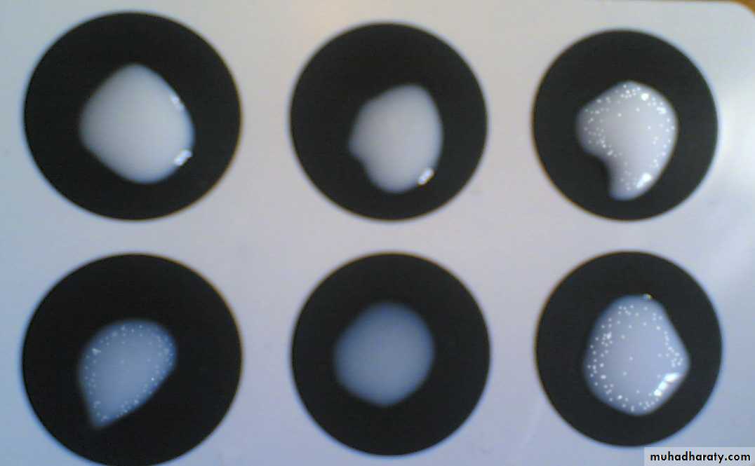 Lab 2 (Ag-Ab reaction)